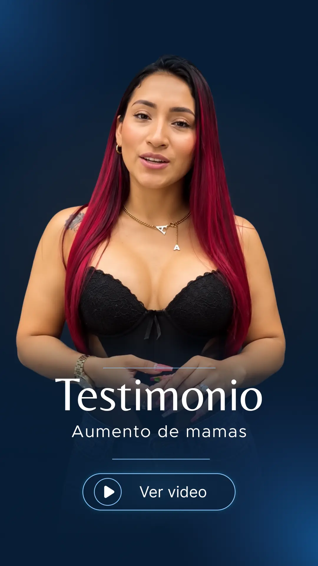 Testimonio: aumento de mamas