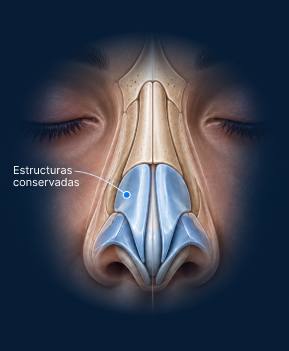 Vista anatómica frontal de rinoplastia de preservación