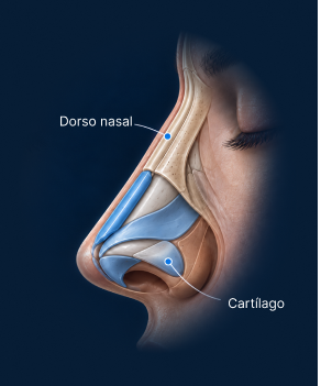 Vista anatómica lateral de rinoplastia de preservación