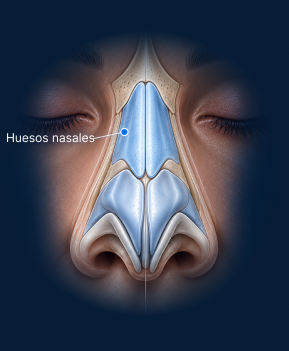 Vista anatómica frontal de rinoplastia ultrasónica